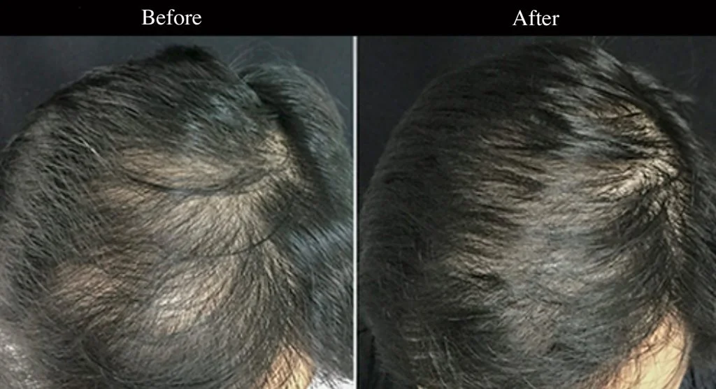 Hair Loss Therapy Headington NHS Dental Practice Oxford Cowley